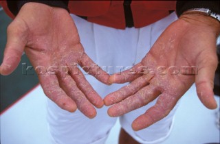 A pair of calloused hands